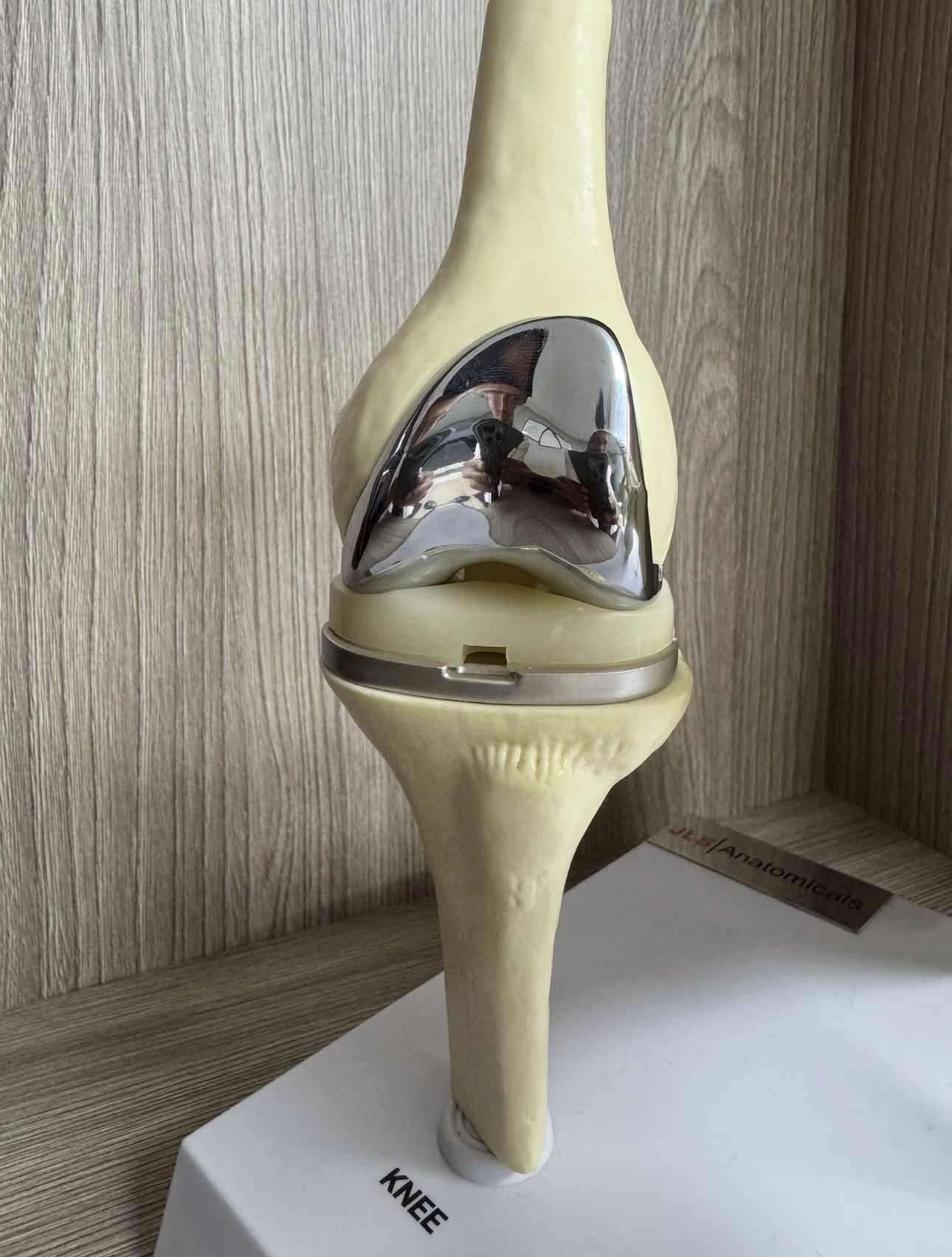 Artroplastia total de rodilla — Componente femoral y plato tibial